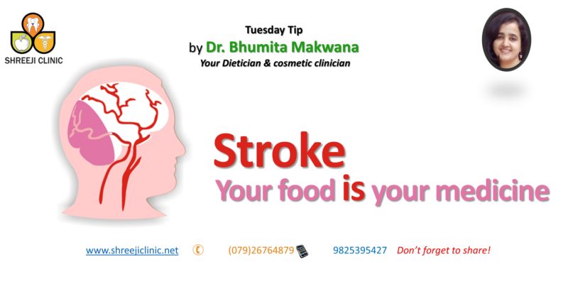 Stroke: Your Food Is Your Medicine