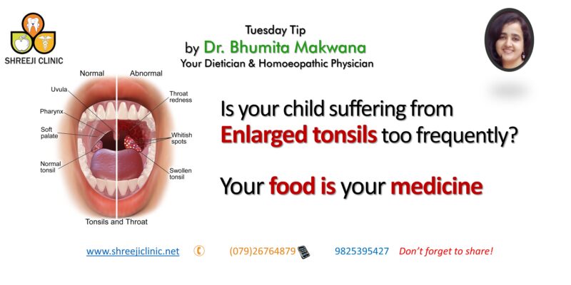 Is Your Child Suffering From-Enlarged Tonsils Too Frequently?  Your Food Is Your Medicine